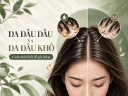 Da Đầu Dầu Và Da Đầu Khô: Cách Nhận Biết Để Gội Đúng