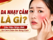 Da Nhạy Cảm Là Gì? Dấu Hiệu Nhận Biết Và Cách Chăm Sóc Đúng Cách