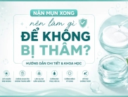 Nặn Mụn Xong Nên Làm Gì Để Không Bị Thâm?