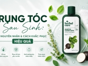 Rụng Tóc Sau Sinh: Nguyên Nhân Và Cách Khắc Phục Hiệu Quả