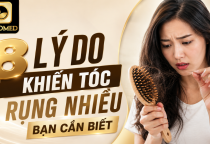 Nguyên Nhân Rụng Tóc: 8 Lý Do Khiến Tóc Rụng Nhiều Bạn Cần Biết