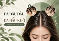 Da Đầu Dầu Và Da Đầu Khô: Cách Nhận Biết Để Gội Đúng