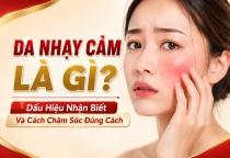Da Nhạy Cảm Là Gì? Dấu Hiệu Nhận Biết Và Cách Chăm Sóc Đúng Cách