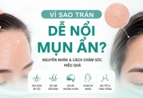 Mụn Ẩn Trên Trán: Nguyên Nhân Và Cách Xử Lý Hiệu Quả