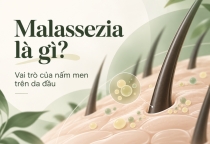 Malassezia Là Gì? Vai Trò Của Nấm Men Trên Da Đầu