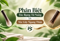 Phân Biệt Tóc Rụng Từ Nang Và Tóc Gãy Ngang Thân