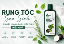 Rụng Tóc Sau Sinh: Nguyên Nhân Và Cách Khắc Phục Hiệu Quả