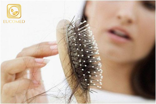nguyên nhân bị rụng tóc sau sinh