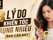 Nguyên Nhân Rụng Tóc: 8 Lý Do Khiến Tóc Rụng Nhiều Bạn Cần Biết