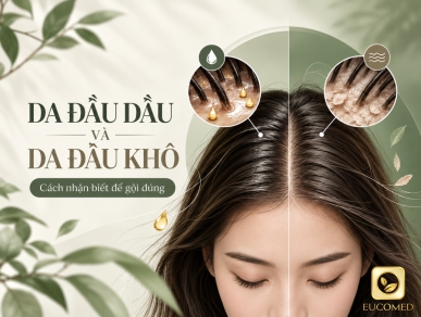 Da Đầu Dầu Và Da Đầu Khô: Cách Nhận Biết Để Gội Đúng