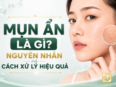 Mụn Ẩn Là Gì? Nguyên Nhân Và Cách Xử Lý Hiệu Quả