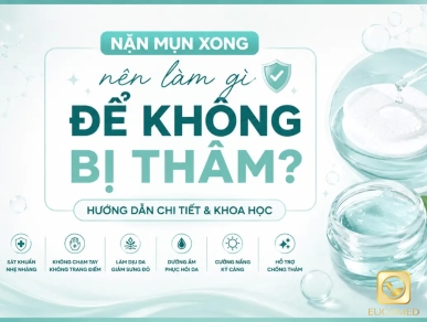 Nặn Mụn Xong Nên Làm Gì Để Không Bị Thâm?